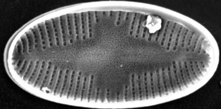 wewnętrznej (internal valve view); 18 Psammothidium marginulatum