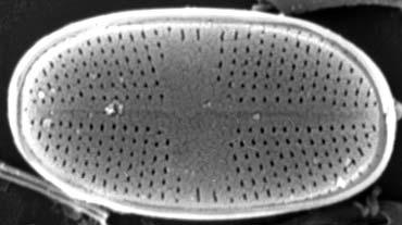 sternum valve view); 20 Psammothidium subatomoides (Hustedt)