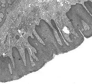 oddechowych śluzowa nosogardzieli zrąb (mięśnie) podśluzowa z gruczołami A