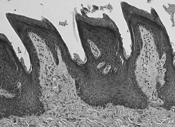 nitkowate foramen caecum okolone liściaste grzybowate wtórne Brodawka pierwotna: