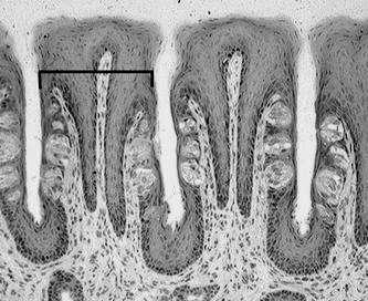 nabłonku bocznych powierzchni liczne kubki smakowe u człowieka z wiekiem zanikają