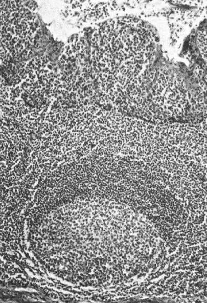 ciemna cytoplazma, mikrokosmki, w dolnej części pęcherzyki zawierające neuroprzekaźniki (serotonina, GABA). Receptory dla smaku kwaśnego.
