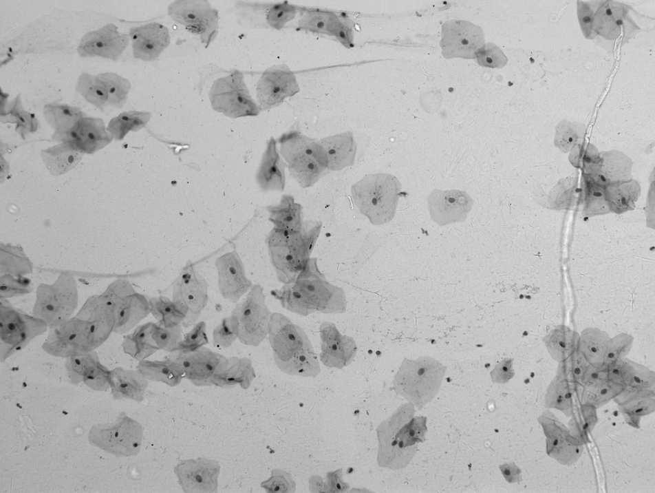 Cytologia wymazów z jamy ustnej barwienie metodą Papanicolaou w wymazie obecne komórki nabłonka z warstwy