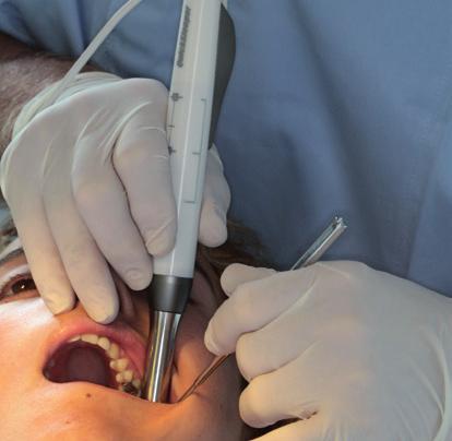 Ustawienie dentysty w trójkącie zatrzonowcowym Ustawienie dentysty w szczęce, żuchwie i obszarze bezzębnym 12