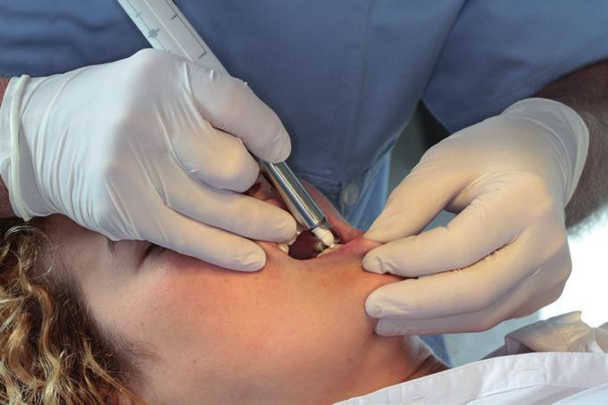 Pozycja dentysty w stosunku do żuchwy Obróć głowę pacjenta do +/- 45 aby uzyskać jak najlepszy dostęp i