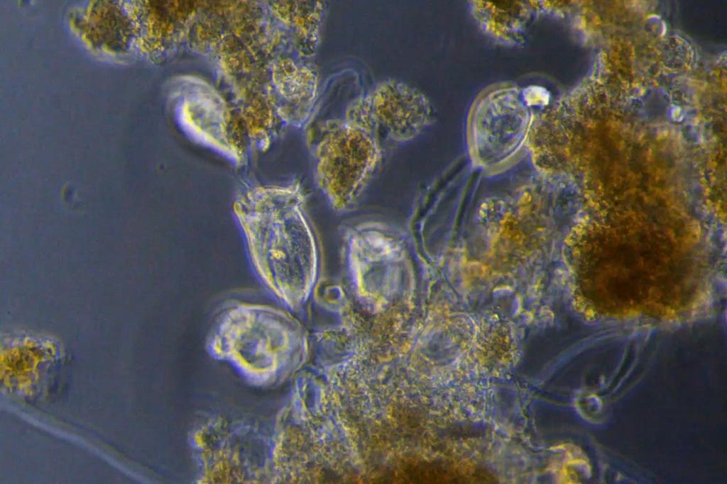 80-140 µm Opercularia minima 400x / 50 µm Zoothanium sp.