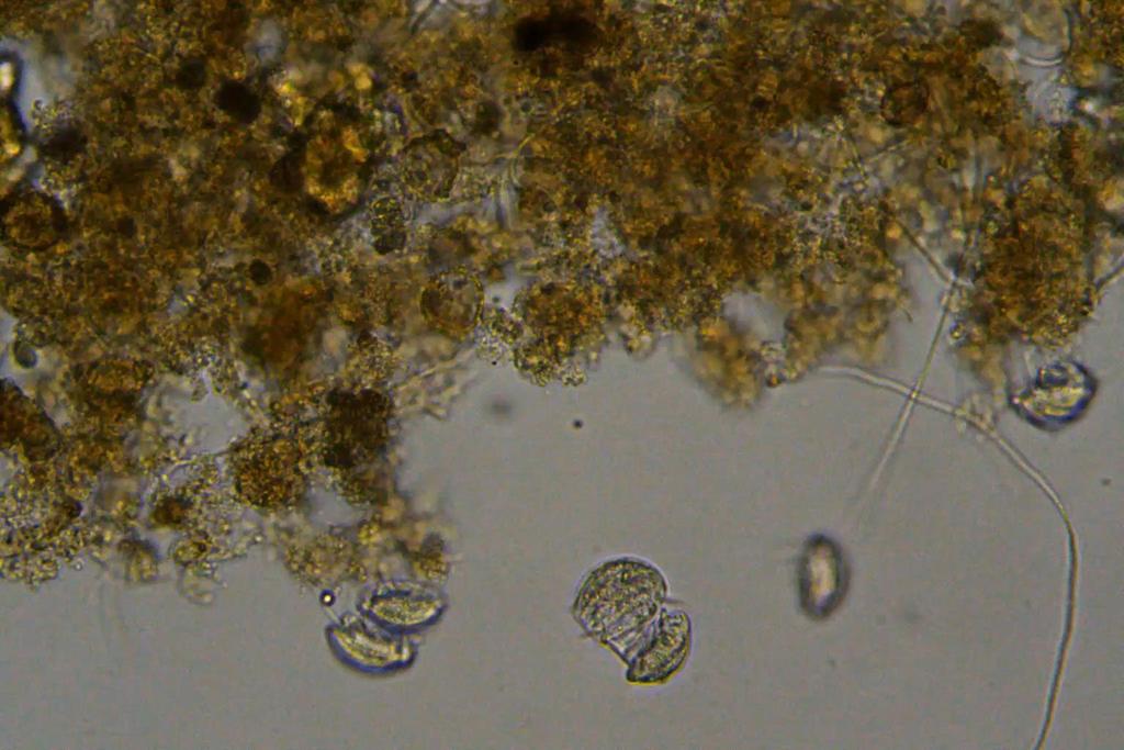 Euplotes affinis 400x / 40-70 µm Aspidisca lynceus 400x