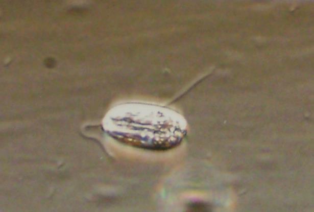1000x / 10-40 µm Arcella sp.