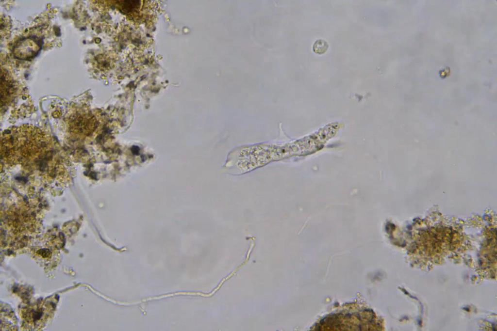 Mayorella sp. 400x / 50 µm Saccamoeba sp.