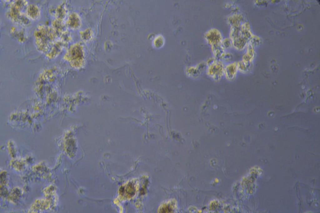 Diplomonadida 1000x / 5-20 µm Notosolenus sp.