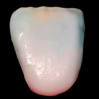 nieco większej fluorescencji można nałożyć w obszarze szyjki np. CT orange-pink.