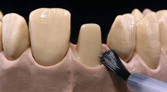 Pierwsze wypalanie dentyny i brzegu siecznego Przed rozpoczęciem nakładania warstwy dentyny i brzegu siecznego model należy zaimpregnować lakierem i zaizolować.