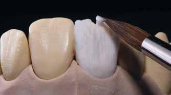 Trzon zębiny należy wymodelować przy użyciu mas Dentin modelując bezpośrednio strukturę palczastą lub nadając uzupełnieniu kształt anatomiczny, a następnie redukując je metodą