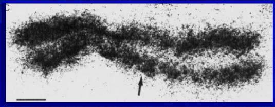 Chromosomy: licz chromosomów W gmetch Eukriot jest o połowę mniej chromosomów niż w komórkch