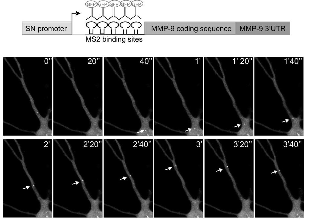 MS2 system to stain targeted mrna in the living cell