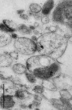 Synaptoneurosomes (SN) Washing and centrifugation Cytosol (C) 1.