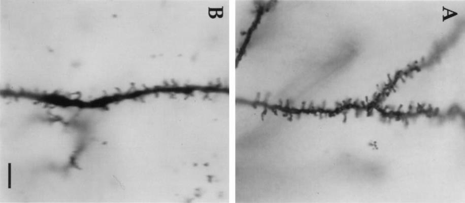 Malformations of the dendritic spines may lead to cognitive disorders One of the characteristic features of FXS neurons is the abnormal