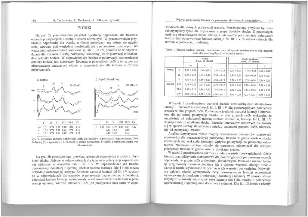 130 G. Tacikowska, K. Kochanek, A. Piłka, A. Jędrusik WYNK Na ryc. 2a przedstawiono przykład rejestracji odpowiedzi dla trzasków o trzech polaryzacjach u osoby o słuchu normalnym.