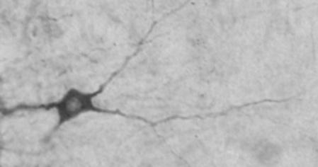 Pobudzenie neuronu jonami potasu (10 mm KCl) powoduje powstanie potencjału czynnościowego w pobudzanym neuronie i wzrost poziomu mrna BDNF w szczytowym odcinku dendrytu (strzałki wskazują miejsca