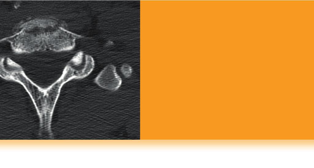 Radiografia cyfrowa, w tym cyfrowa artrografia i angiografia subtrakcyjna (DS). 3. Prześwietlenie (skopia), standardowe lub w połączeniu z nagraniem wideo. 4. Tomografia komputerowa (TK). 5.