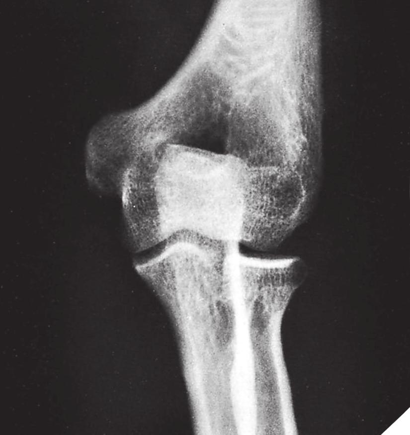 ROZDZIŁ 4 Diagnostyka radiologiczna w urazach 59 RYCIN 4.