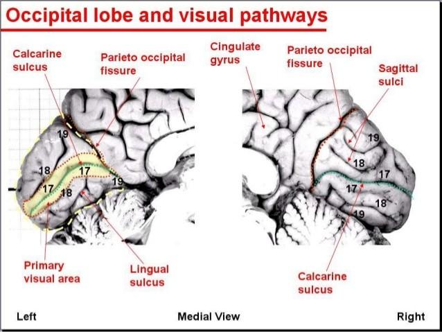 visual C1 (65-90 ms) powstaje w 1-rzędowej korze wzrokowej (striate cortex BA17 V1 - calcarine sulcus (V1) polaryzacja różna w zależności od