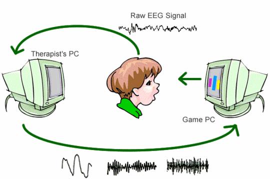 Neurofeedback-EEG Metoda terapeutyczna polegająca na podawaniu pacjentowi sygnałów zwrotnych o zmianach stanu aktywności