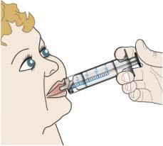 10. Podać lek dziecku. Należy zrobić to natychmiast po wymieszaniu dawki leku. Umieścić końcówkę strzykawki w ustach dziecka, po wewnętrznej stronie policzka.