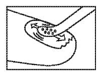 6. Lek Ciclolack nałożyć równomiernie na całą powierzchnię zakażonego paznokcia, używając szpatułki. 7.