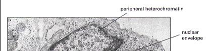 chromatyna w róŝnej formie skondensowania: euchromatyna