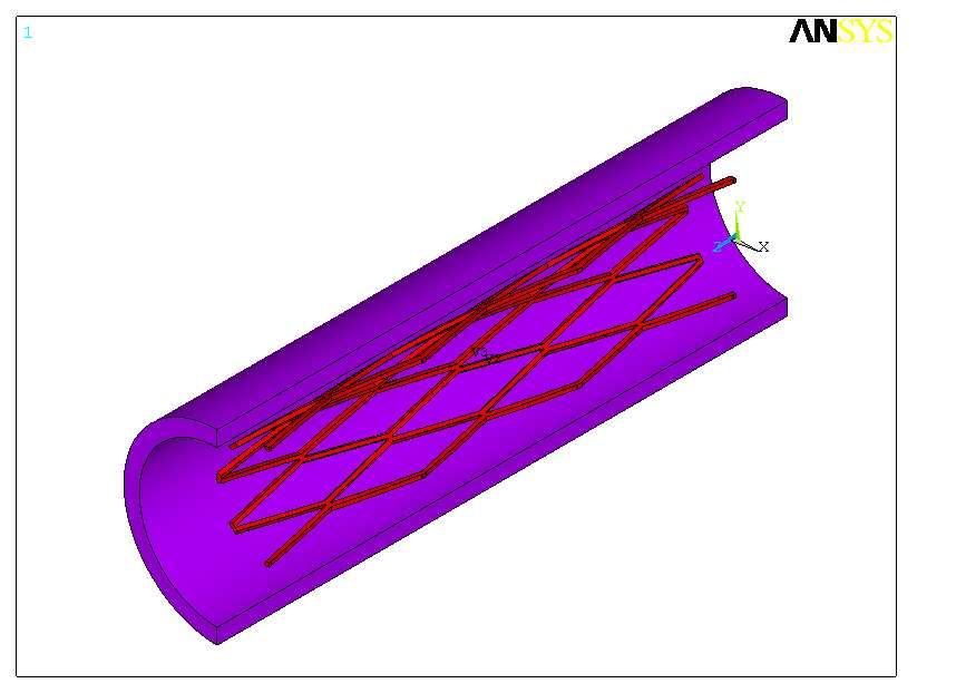 Dla tak przygotowanego modelu przyjto nastpujce własnoci materiałowe [5]: moduł Younga (E 1 = 7,5 MPa), liczba Poisson a (ν 1 = 0.44).