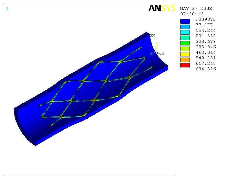 Analiza stanu napre i przemieszcze w warunkach angioplasyki wiecowej 595 0 0 0-0 0 0 22,6 0,5 7 690 0 0,02 0,07 0 0,01 21,1 1 0 692 0 0,30 0,56 0,06 0,16 14,5 1,2 0 693 0 0,35 0,8 0,59 0,09 0,18 14,2