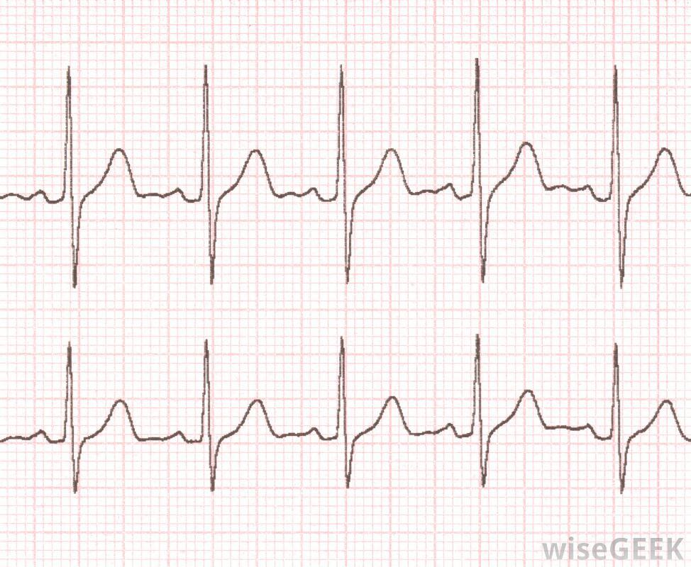 Periodická funkce Definice Zdroj : http://www.wisegeek.com/what-is-a-portable-ekg.