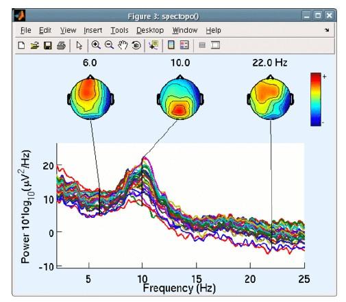 analiza spektralna EEG rozkład