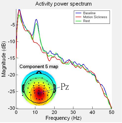 ABS vs REL spectral power absolutna [µv2] vs relatywna