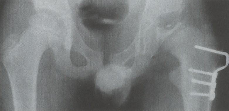 Operacje