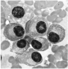mastocytów Magazynowane w ziarnach: histamina heparyna proteazy (chymaza i tryptaza) czynniki chemotaktyczne