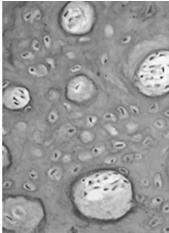 KOŚĆ komórki: - komórki osteogenne - osteoblasty - osteocyty - osteoklasty substancja międzykomórkowa: - fosforany