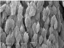 osteogenne: spłaszczone ubogie w organelle lokalizacja w dojrzałej kości: (nieliczne, spoczynkowe) w okostnej, w