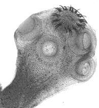 międzypalcowa), 1 2 3 B Epidermophyton flocossum stopa mokasynowa /stopa atlety 3 grzybica owłosionej skóry brody C Microsporum canis 4. Podpisz zdjęcia: 4.