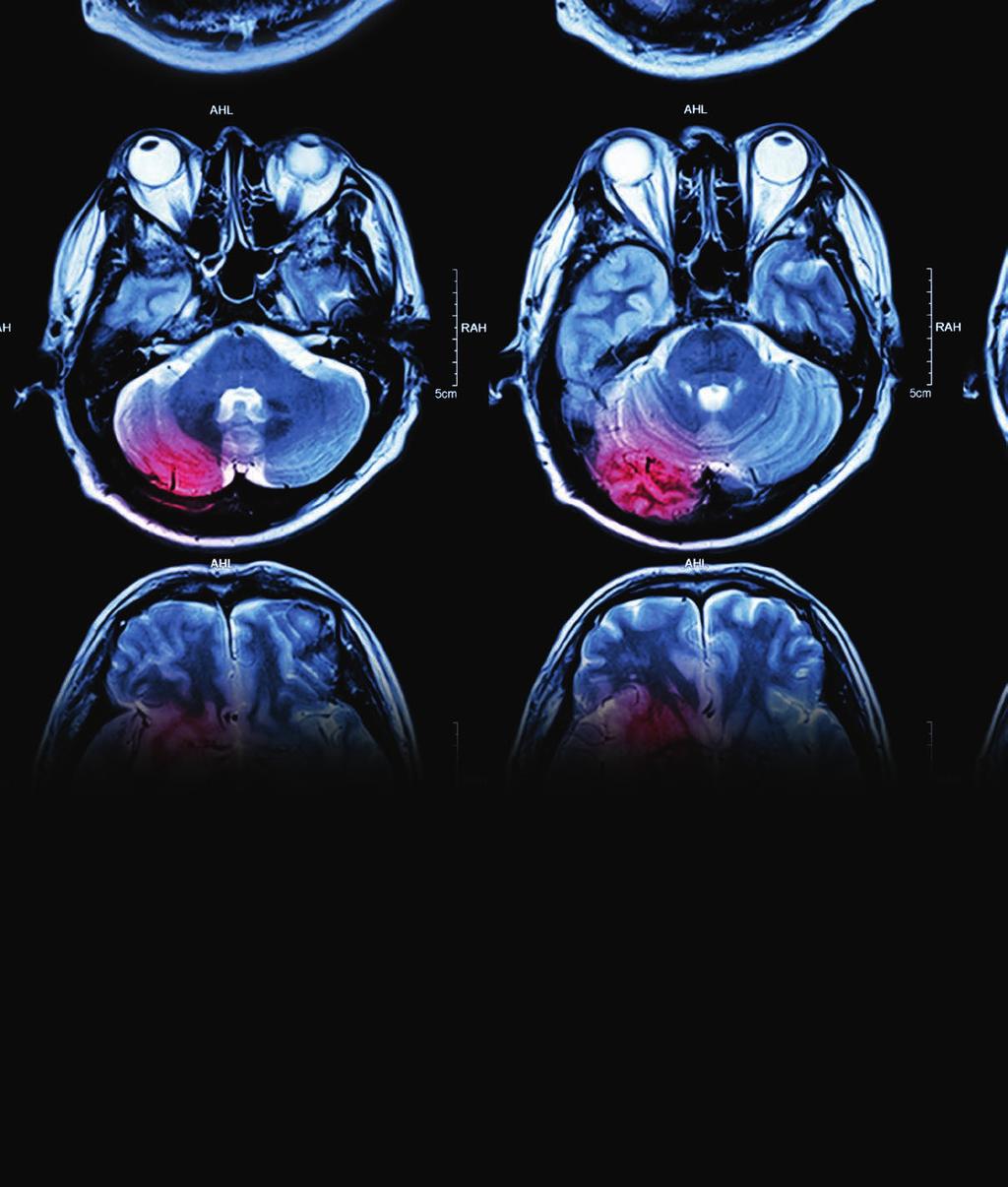 Radiologia zabiegowa aktualne możliwości mgr inż.