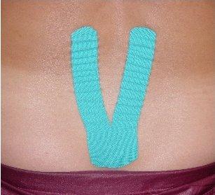 KinesioTaping Normalizacja napięcia