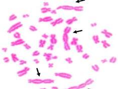 charakterze przeciwnowotworowym: cytotoksyczność