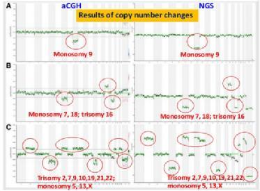 Badania prenatalne- PGS Preimplantation Genetic Screening Badania prenatalne- PGD Preimplantation Genetic Diagnostic Testy genetyczne mukowiscydoza anemia sierpowata rdzeniowy zanik mięśni choroba