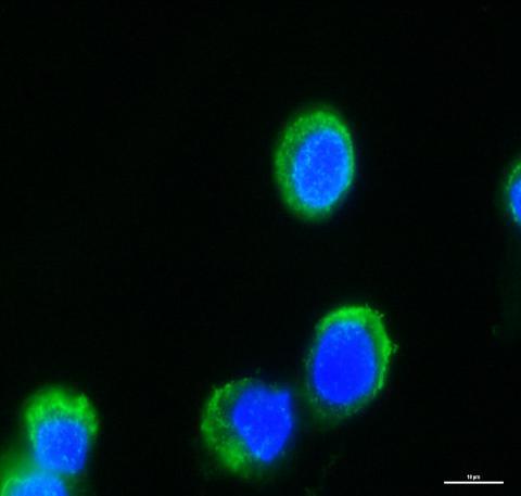 Immunocytochemiczna analiza wiązania