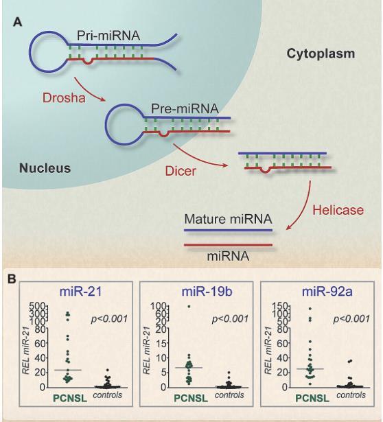 mirna w PCNSL mirna - to krótki, niekodujący odcinek RNA, którego nadmierna ekspresja związana jest z występowaniem wielu nowotworów.