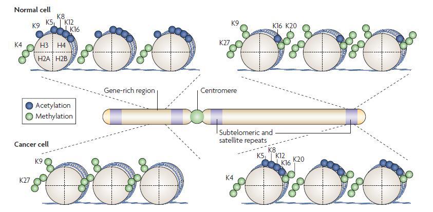 Wzór modyfikacji histonów rdzeniowych w komórkach niezmienionych i nowotworowych Komórka zdrowa Obszary bogate w geny Geny supresorowe