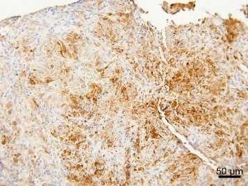 Granulomatous Inflammation indukowanego przez nano-rurki węglowe u myszy