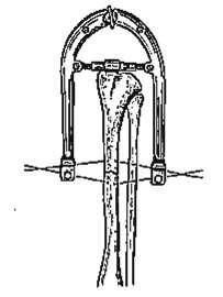 Stabilizator rozciągowo