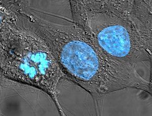 http://pl.wikipedia.org/w/index.php?title=plik:hela_cells_stained_with_hoechst_33258.